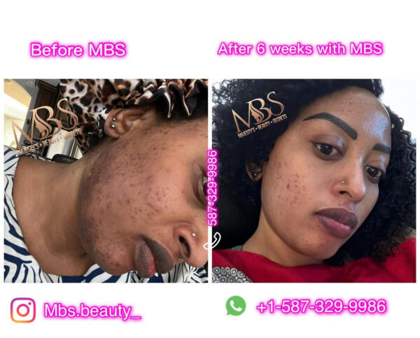 Repair Face Kit - Image 6