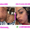 Repair Face Kit - Image 8