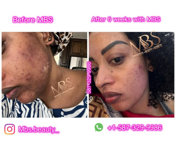 Repair Face Kit - Image 8