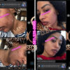 Repair Face Kit - Image 7