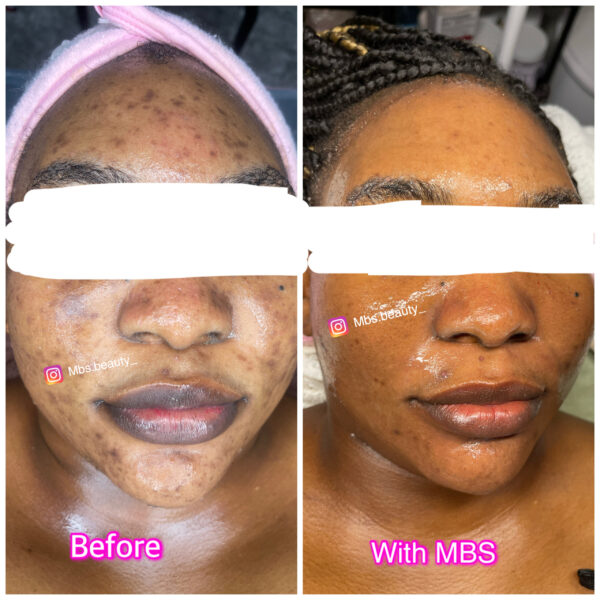 Repair Face Kit - Image 9