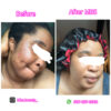 Repair Face Kit - Image 10