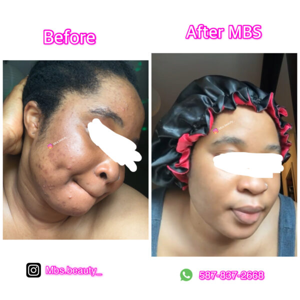 Repair Face Kit - Image 10