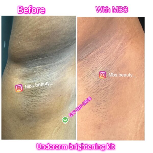 Under-Arm Brightening Kit - Image 3