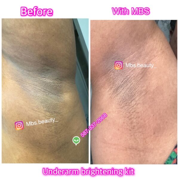 Under-Arm Brightening Kit - Image 2