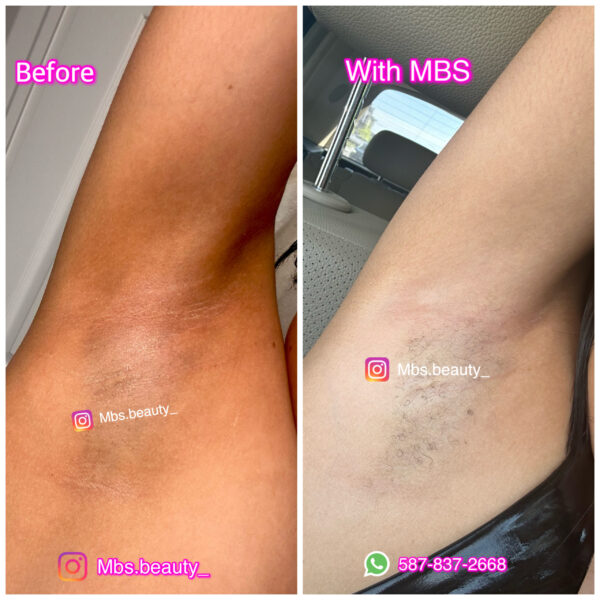 Under-Arm Brightening Kit - Image 4